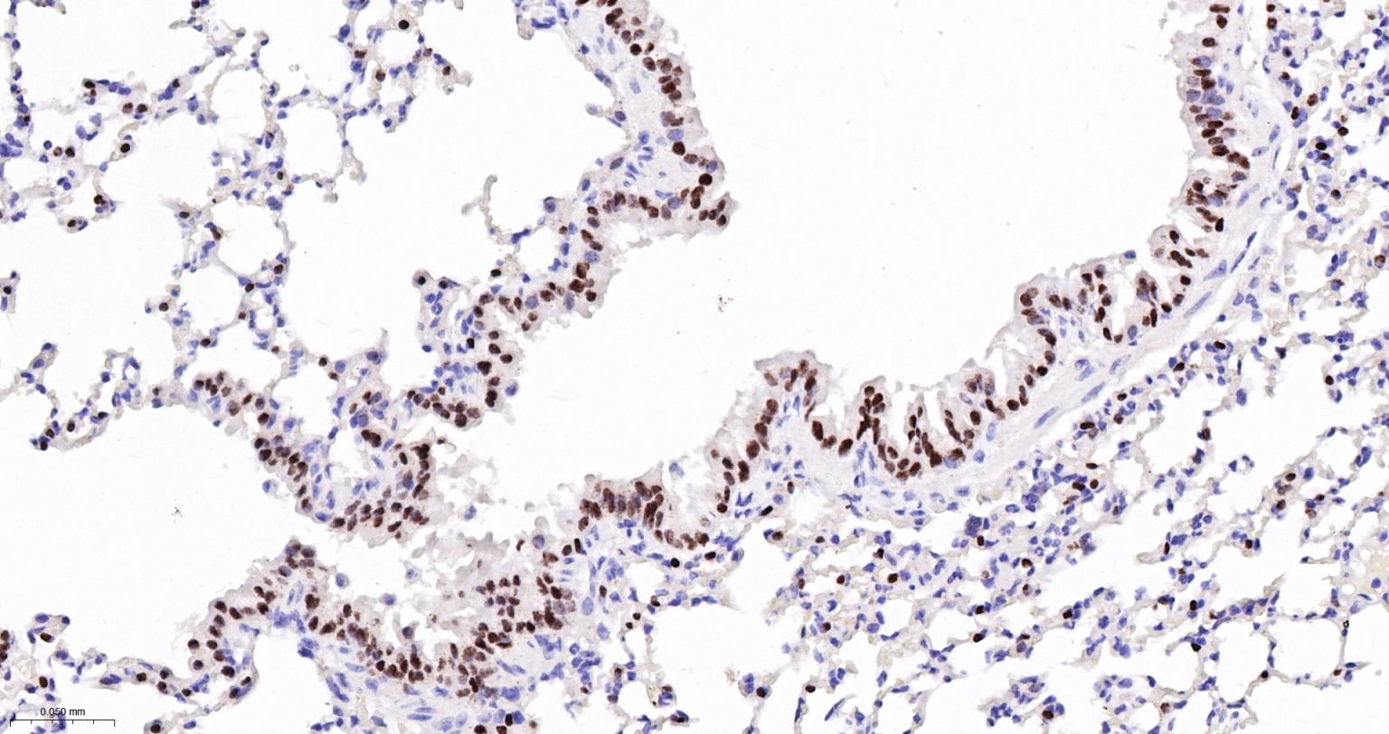 甲状腺核转录因子-1重组兔单抗-bsm-60241R