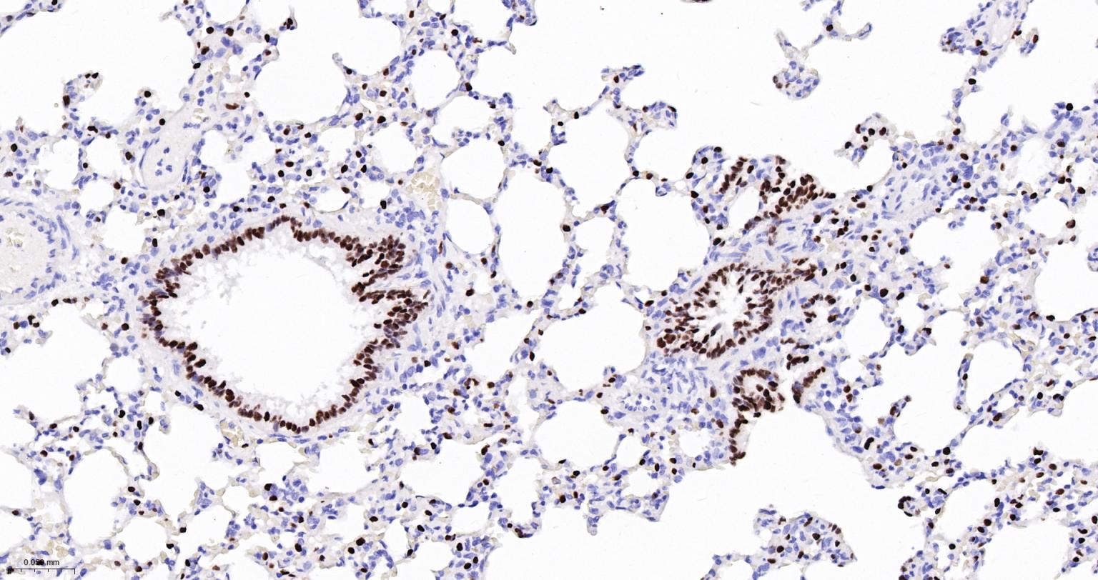 甲状腺核转录因子-1重组兔单抗-bsm-60241R