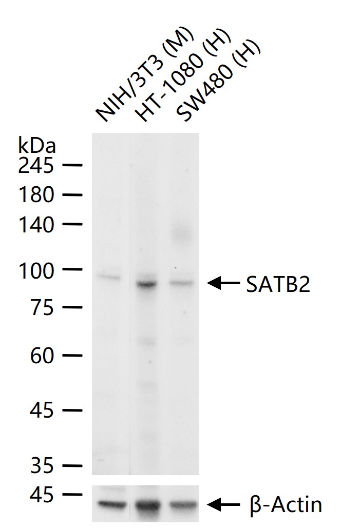 DNA结合蛋白2重组兔单抗-bsm-62976R