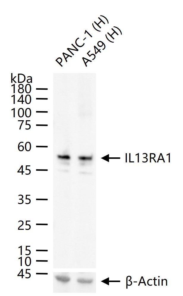白细胞介素-13受体a1重组兔单抗-bsm-54211R