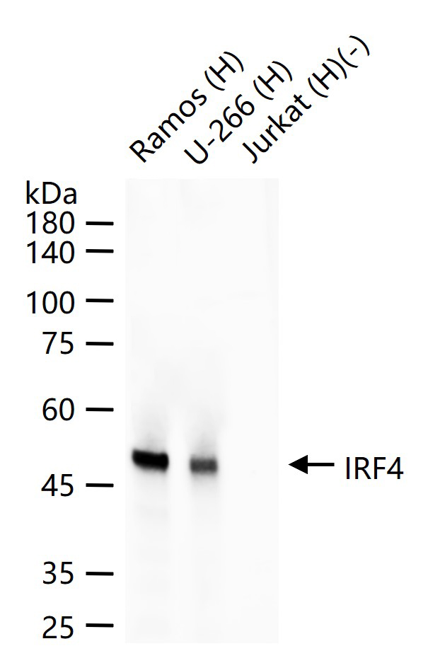 干扰素调节因子4重组兔单抗-bsm-62837R