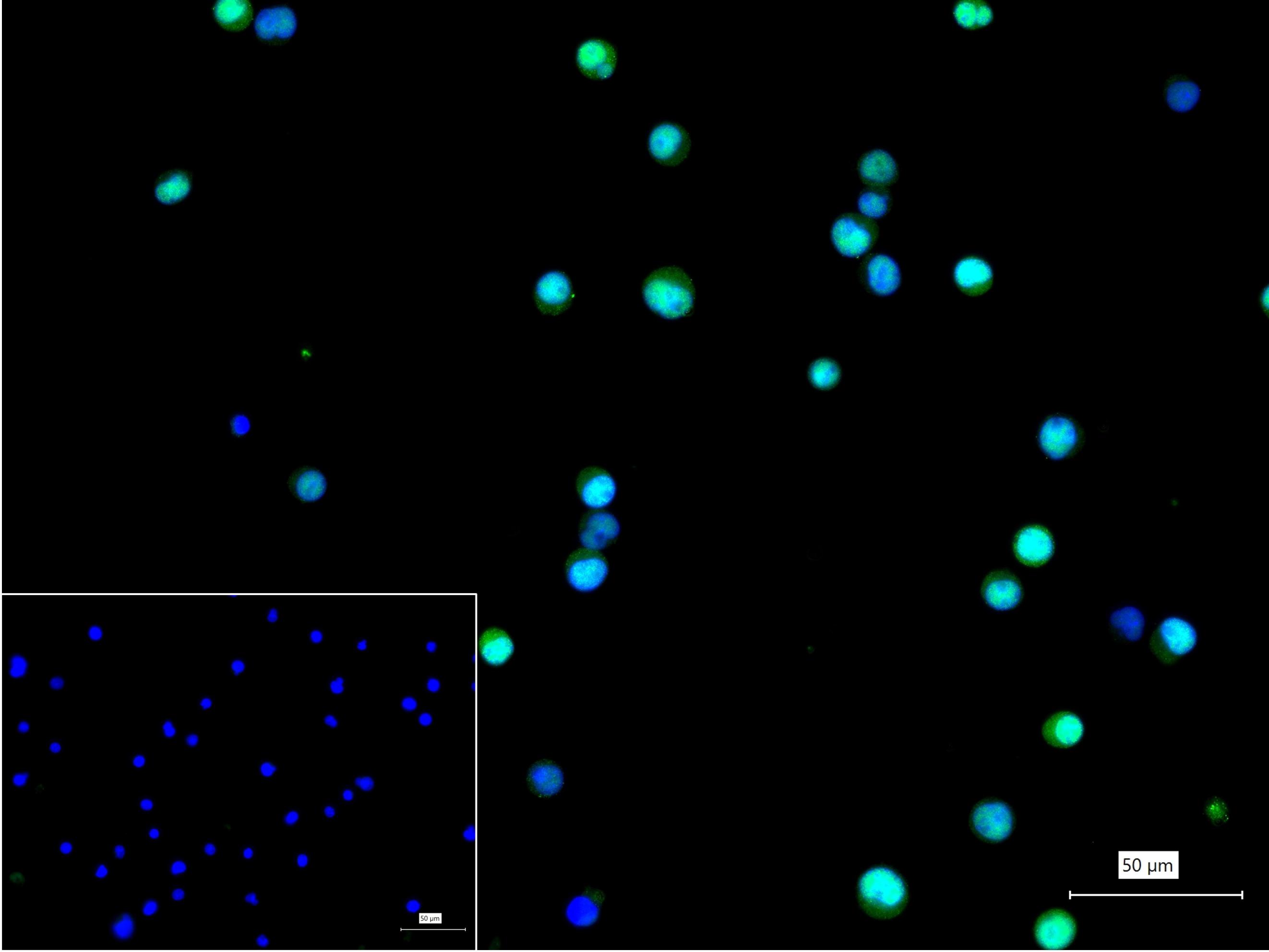缺氧诱导因子1α抑制蛋白/HIF1AN重组兔单抗-bsm-61905R
