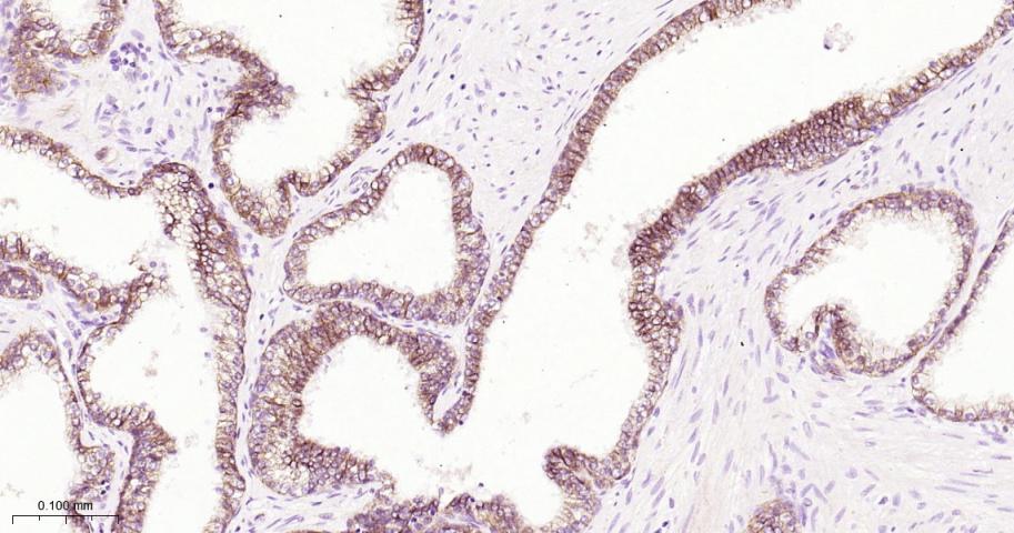 β-连环蛋白/β-连环素/β链接素重组兔单抗-bsm-55526R