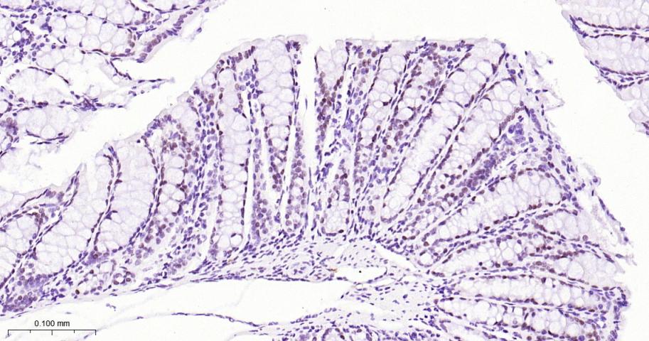 DNA结合蛋白2重组兔单抗-bsm-62976R