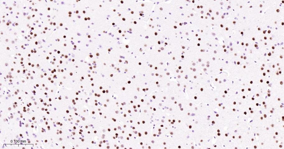 DNA结合蛋白2重组兔单抗-bsm-62976R