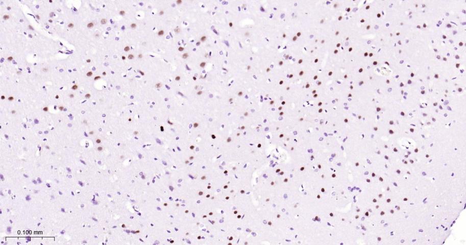 DNA结合蛋白2重组兔单抗-bsm-62976R