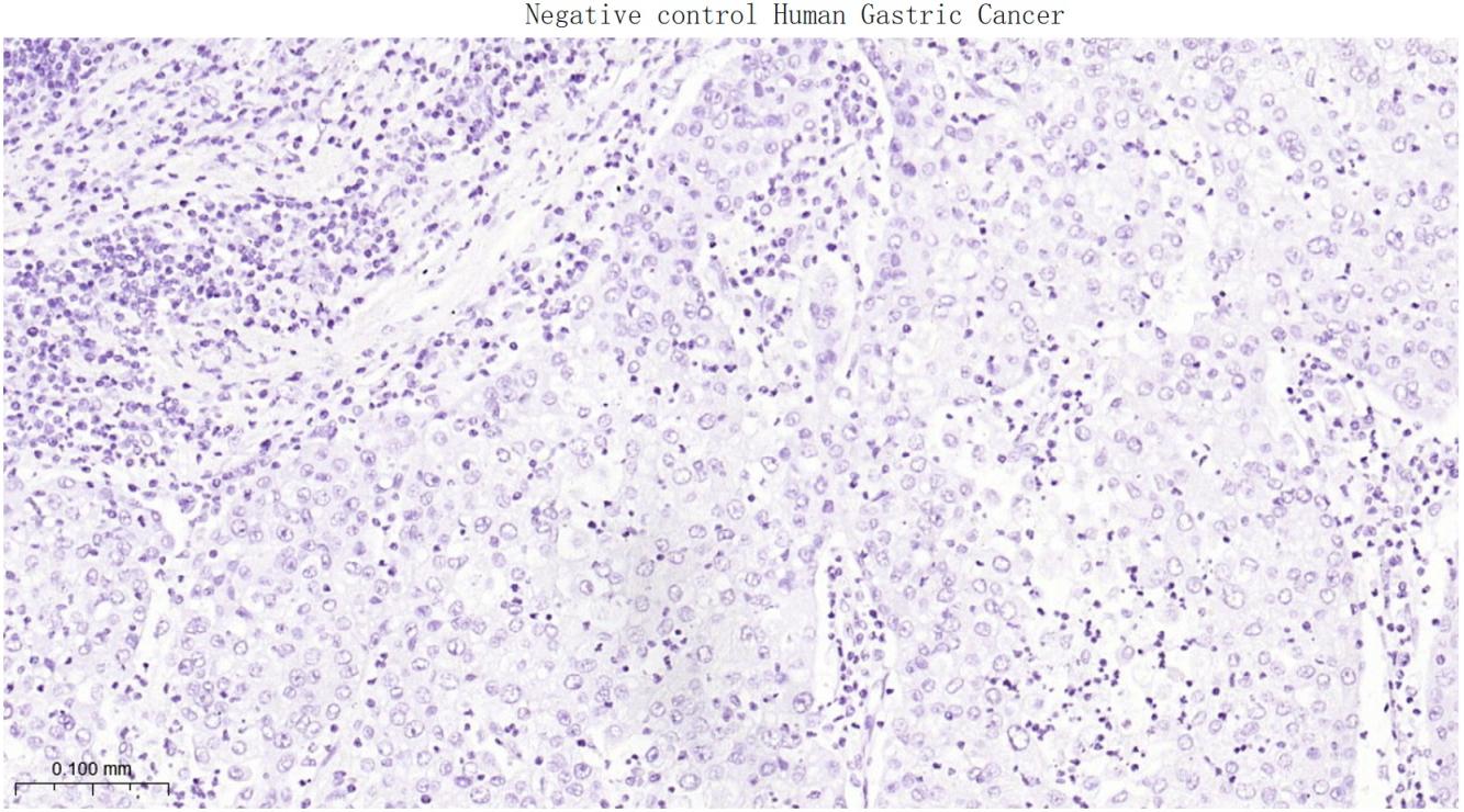 DNA结合蛋白2重组兔单抗-bsm-62976R