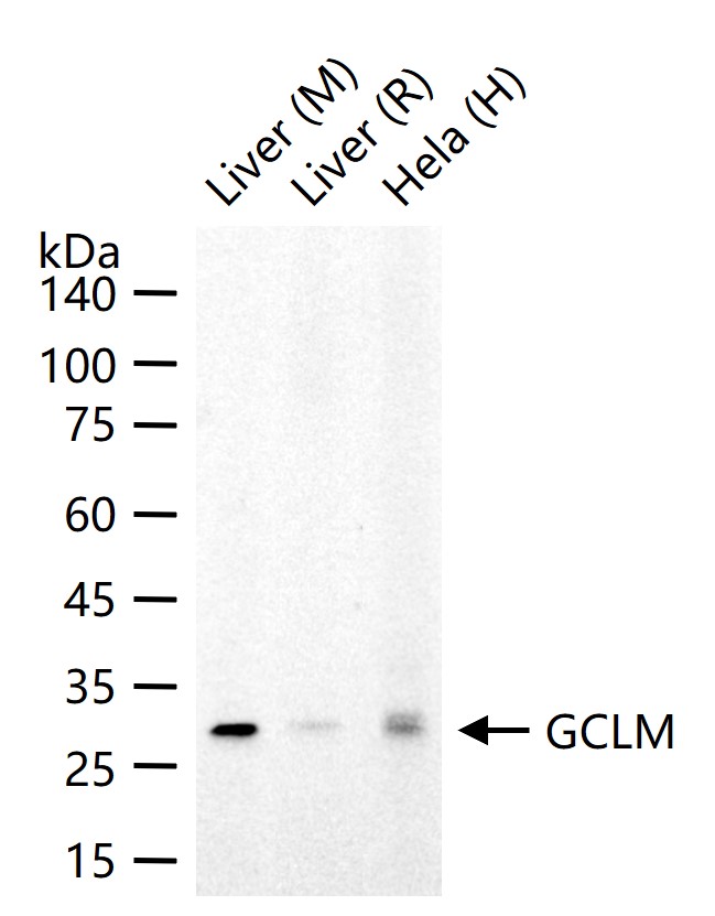 GCLM重组兔单抗-bsm-54141R