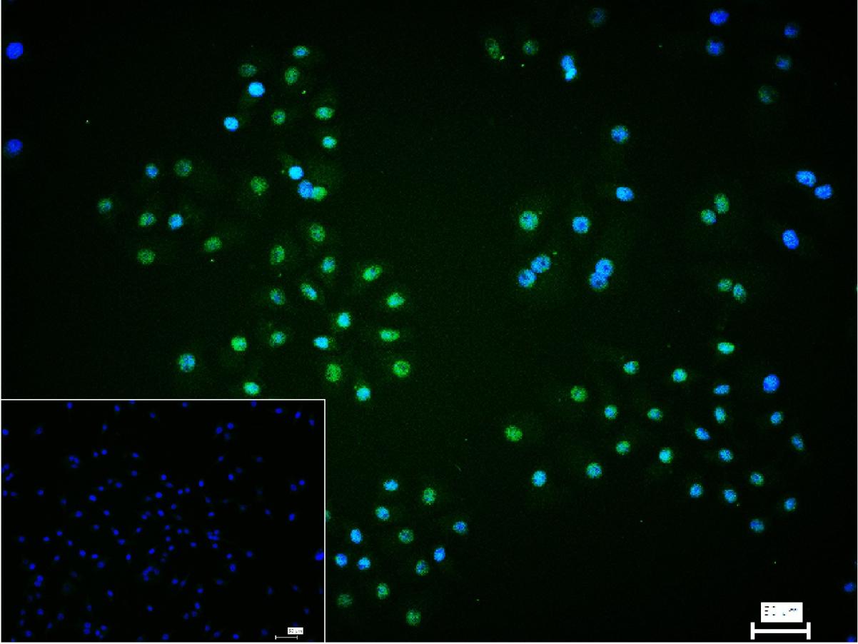 缺氧诱导因子1β/HIF-1β重组兔单抗-bsm-52092R