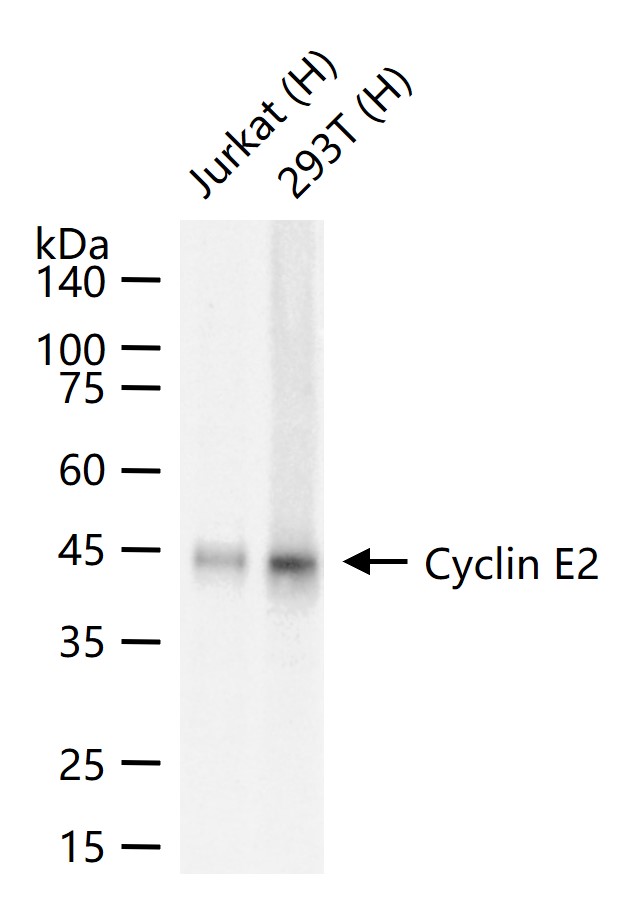 周期素E2重组兔单抗-bsm-52049R