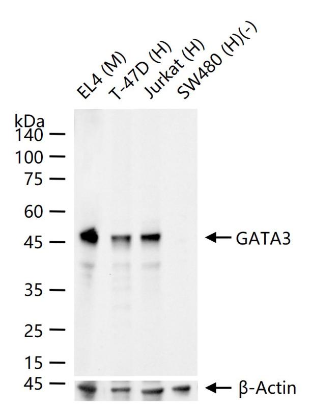 GATA结合蛋白3重组兔单克隆抗体-bsm-60794R
