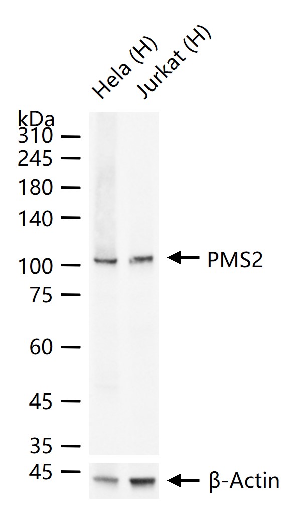 肿瘤错配修复基因PMS2重组兔单抗-bsm-55559R