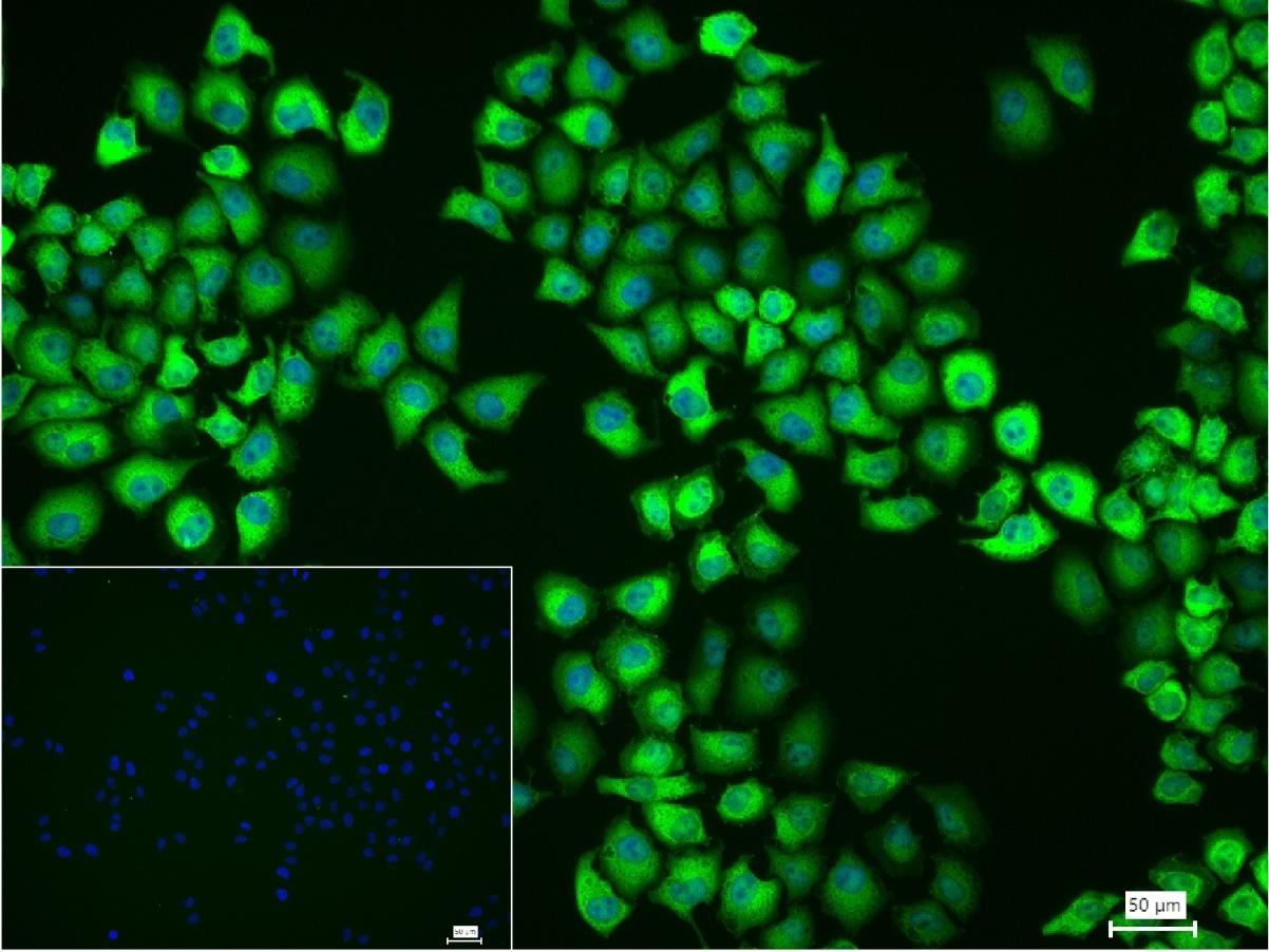 热休克蛋白90β/HSP90 β 重组兔单抗-bsm-61128R