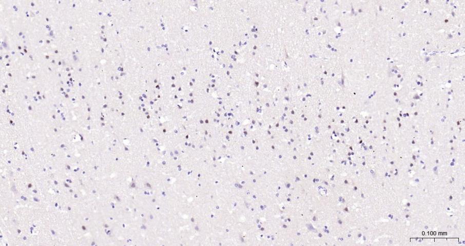 早期生长应答蛋白1重组兔单抗-bsm-61687R