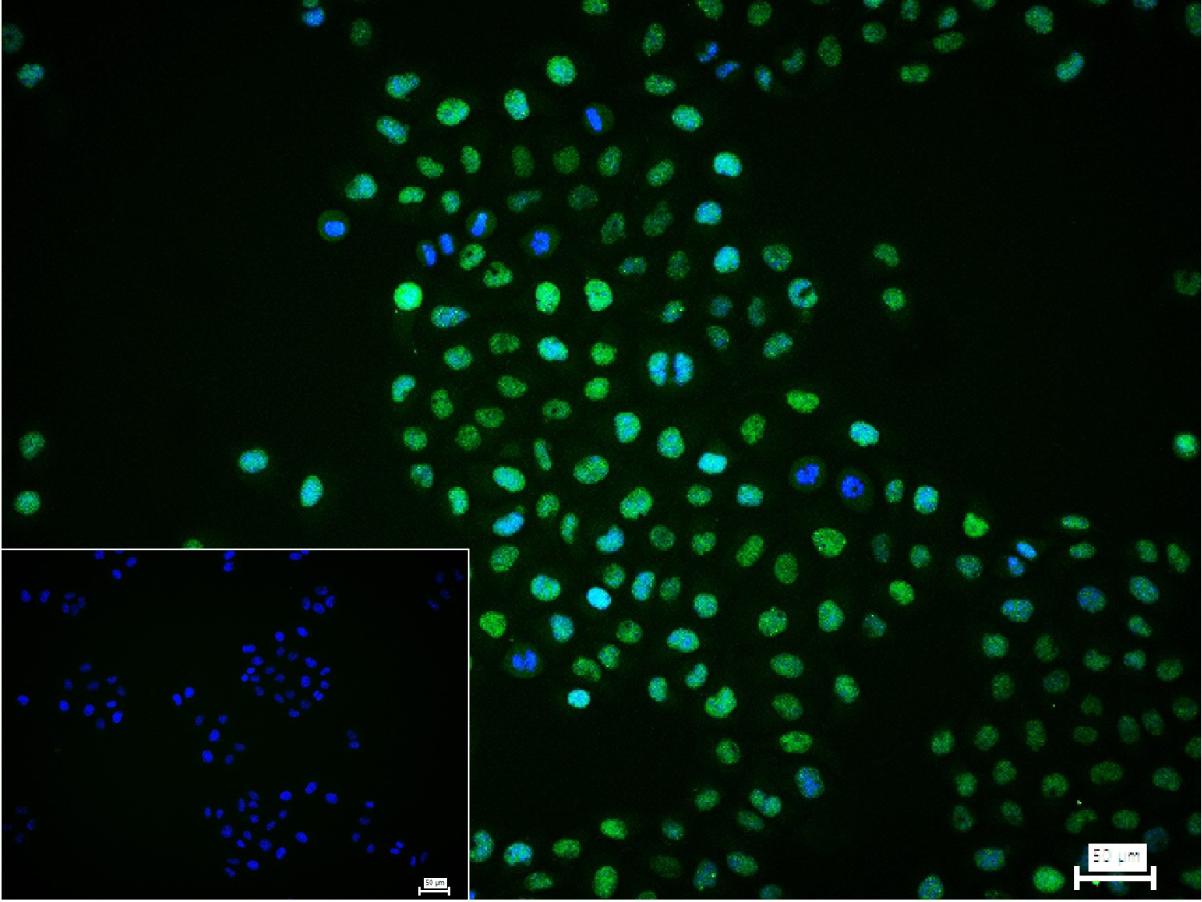 缺氧诱导因子1α /HIF-1α重组兔单抗-bsm-62518R