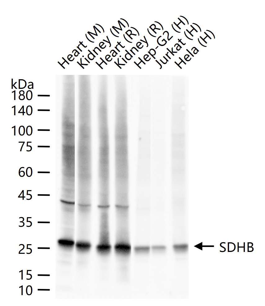 铬细胞瘤患者抑癌基因SDHB重组兔单抗-bsm-54180R