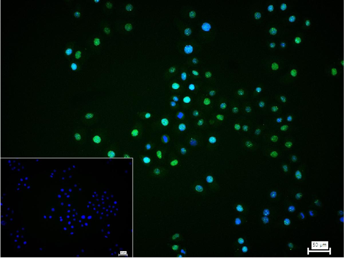 缺氧诱导因子1α /HIF-1α重组兔单抗-bsm-62518R