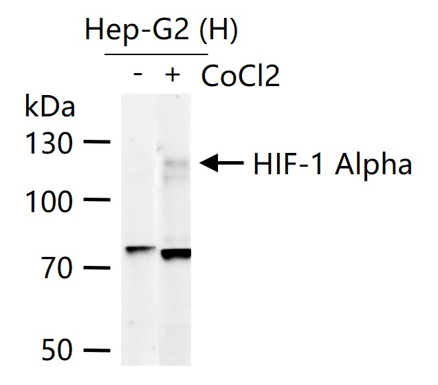 缺氧诱导因子1α /HIF-1α重组兔单抗-bsm-62518R