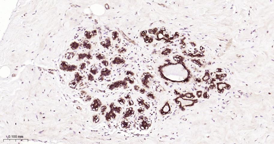 细胞角蛋白18重组兔单抗-bsm-52058R