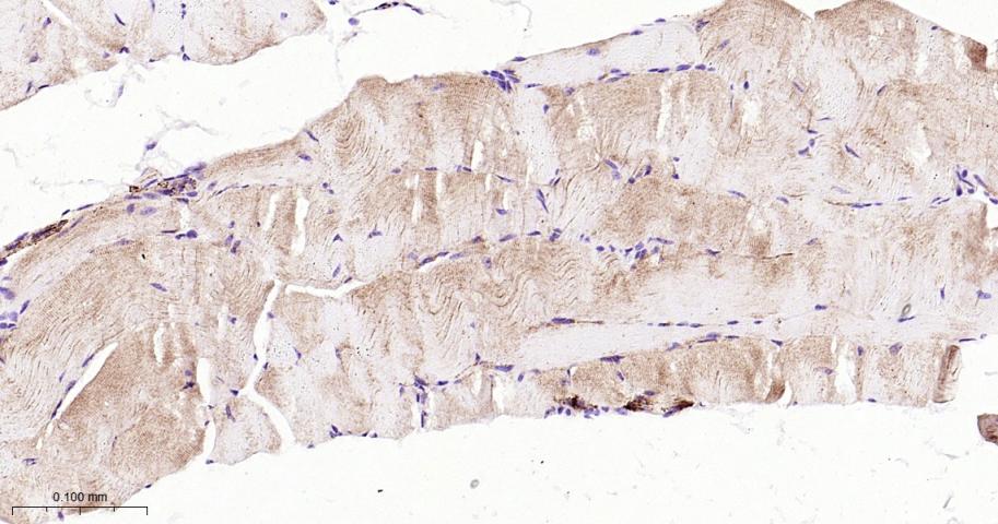 GCLM重组兔单抗-bsm-54141R