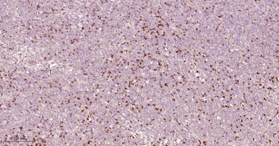 zeta相关蛋白70重组兔单抗-bsm-54192R