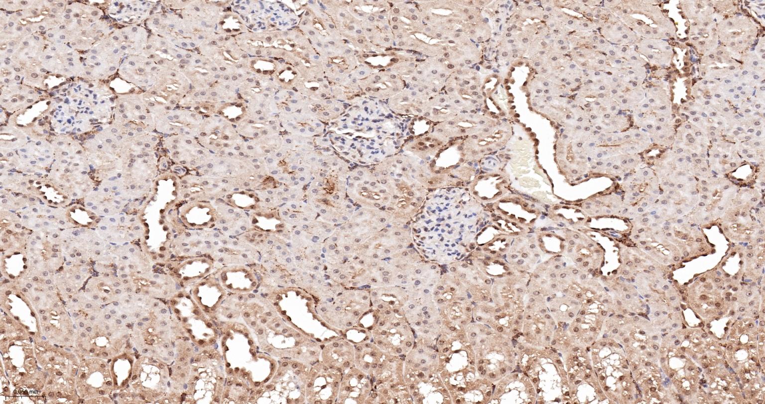 细胞核转录因子X盒结合蛋白重组兔单抗-bsm-61423R