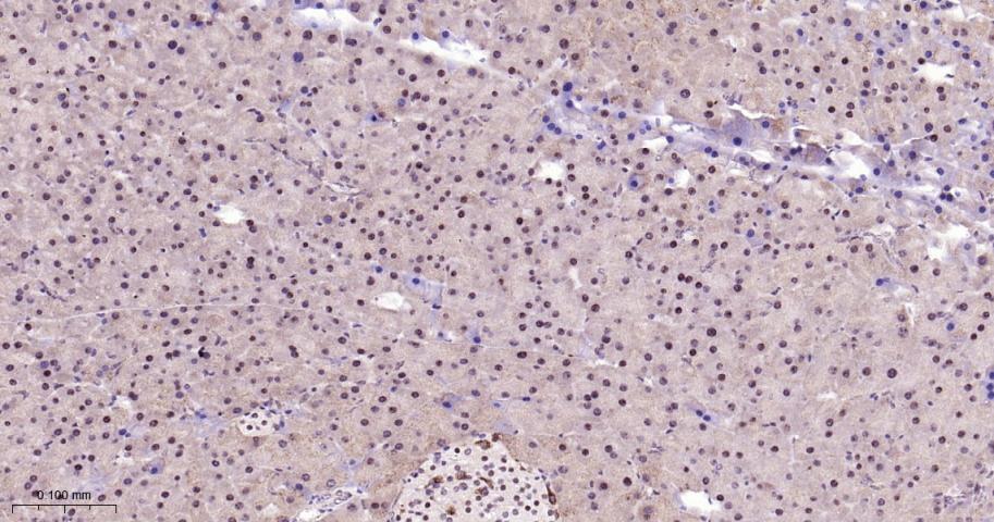 细胞核转录因子X盒结合蛋白重组兔单抗-bsm-61423R