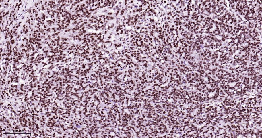 热休克因子1重组兔单抗-bsm-63270R
