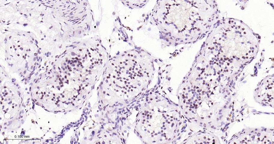 缺氧诱导因子1β/HIF-1β重组兔单抗-bsm-52092R