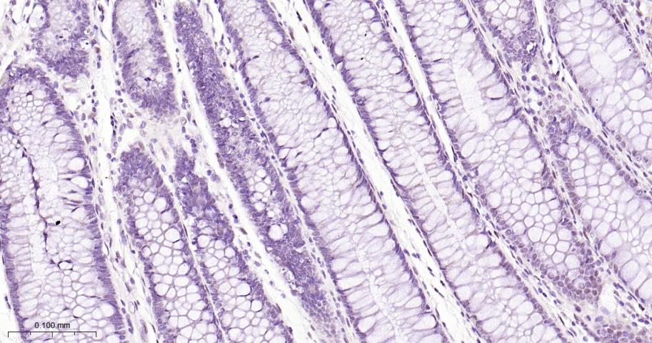 缺氧诱导因子1β/HIF-1β重组兔单抗-bsm-52092R