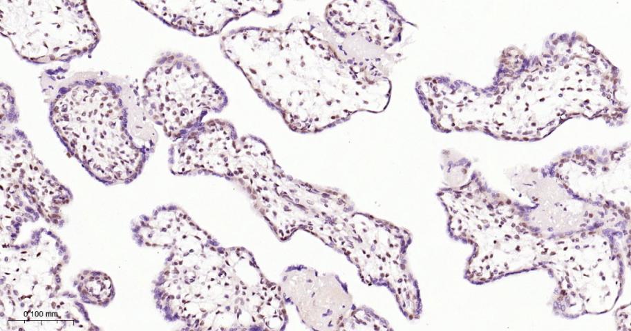 缺氧诱导因子1β/HIF-1β重组兔单抗-bsm-52092R