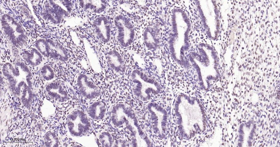 缺氧诱导因子1β/HIF-1β重组兔单抗-bsm-52092R