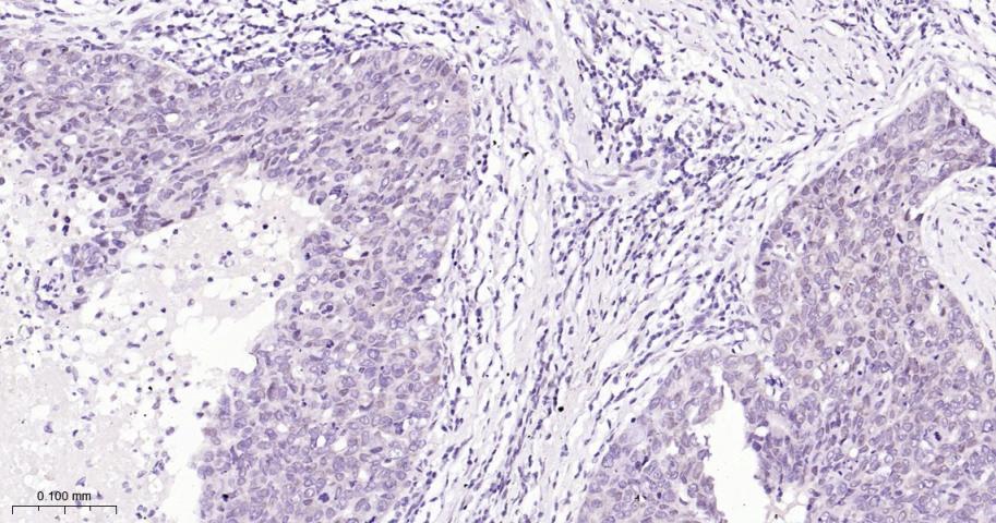 缺氧诱导因子1β/HIF-1β重组兔单抗-bsm-52092R