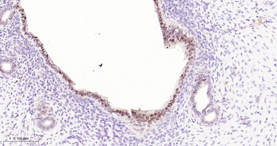 配对盒基因8重组兔单抗-bsm-52737R