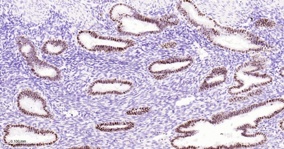 配对盒基因8重组兔单抗-bsm-52737R