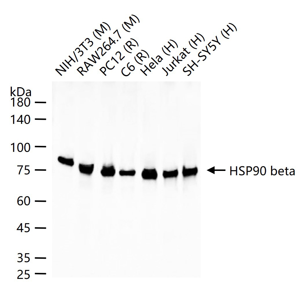 热休克蛋白90β/HSP90 β 重组兔单抗-bsm-61128R