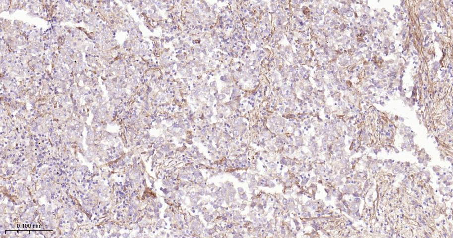 整合素β1（CD29）重组兔单抗-bsm-52266R