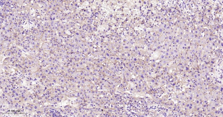 整合素β1（CD29）重组兔单抗-bsm-52266R