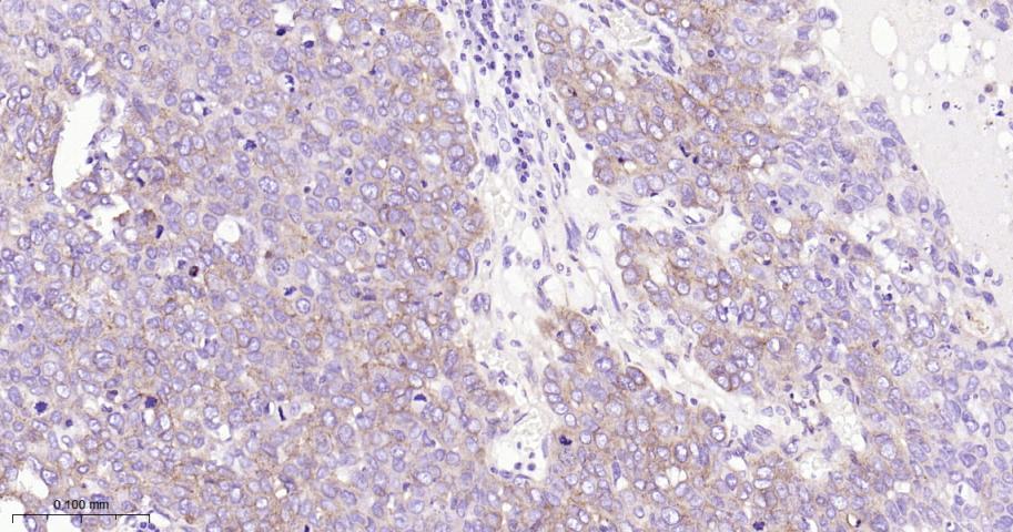 整合素β1（CD29）重组兔单抗-bsm-52266R