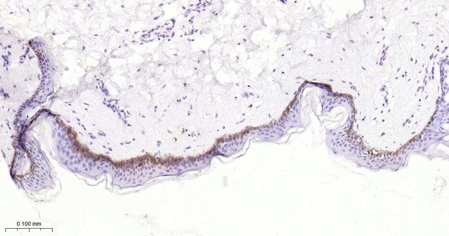整合素β1（CD29）重组兔单抗-bsm-52266R