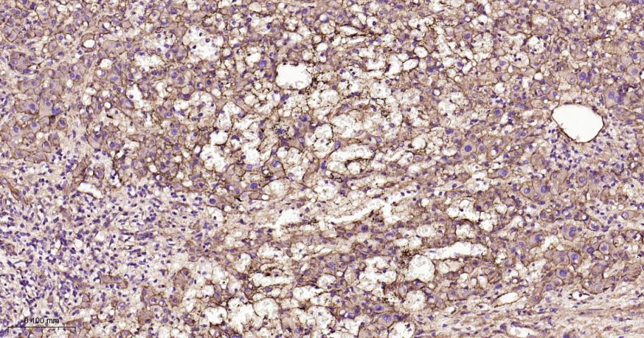 整合素β1（CD29）重组兔单抗-bsm-63321R