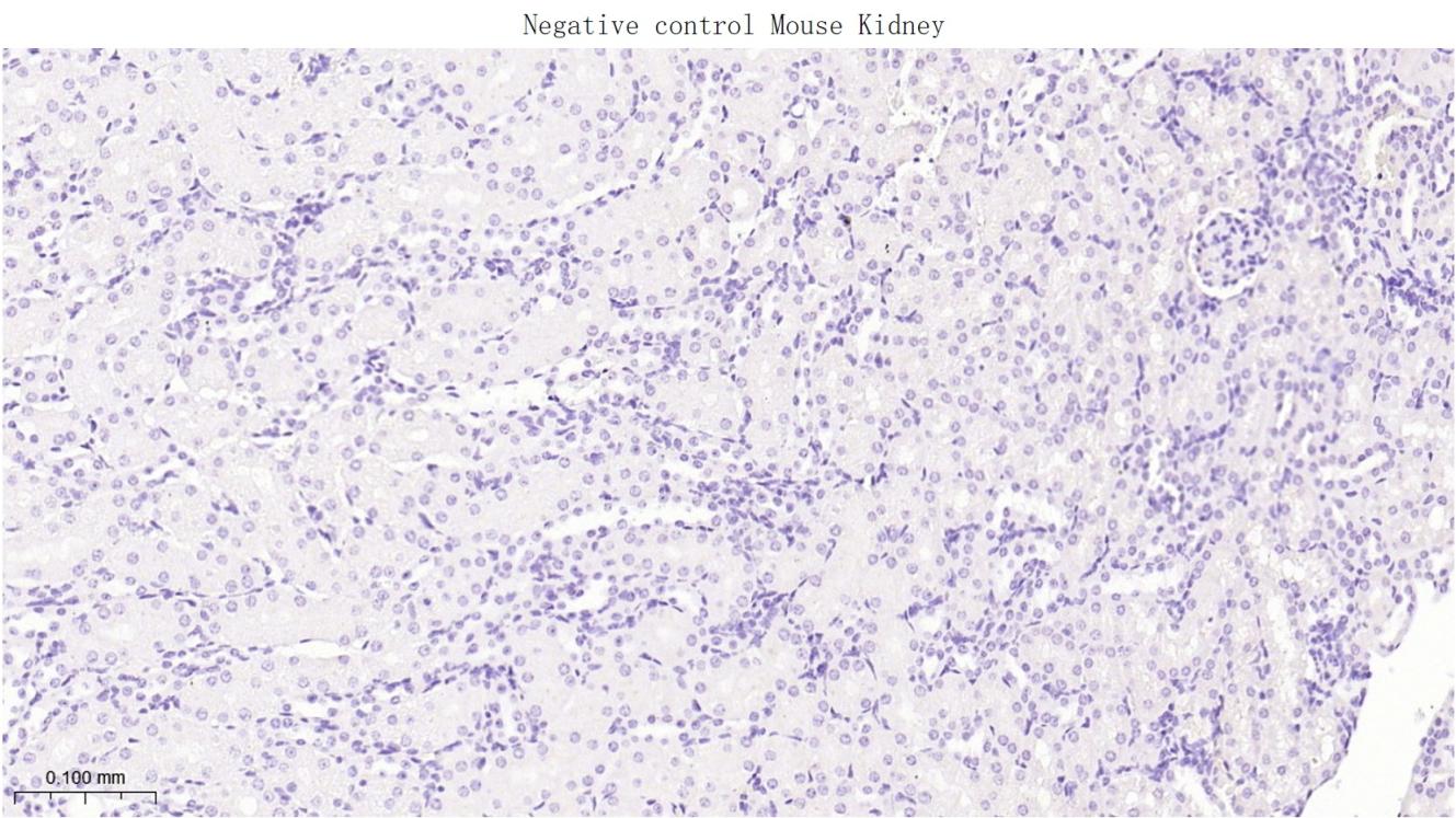 肝肠钙粘连蛋白重组兔单抗-bsm-60434R