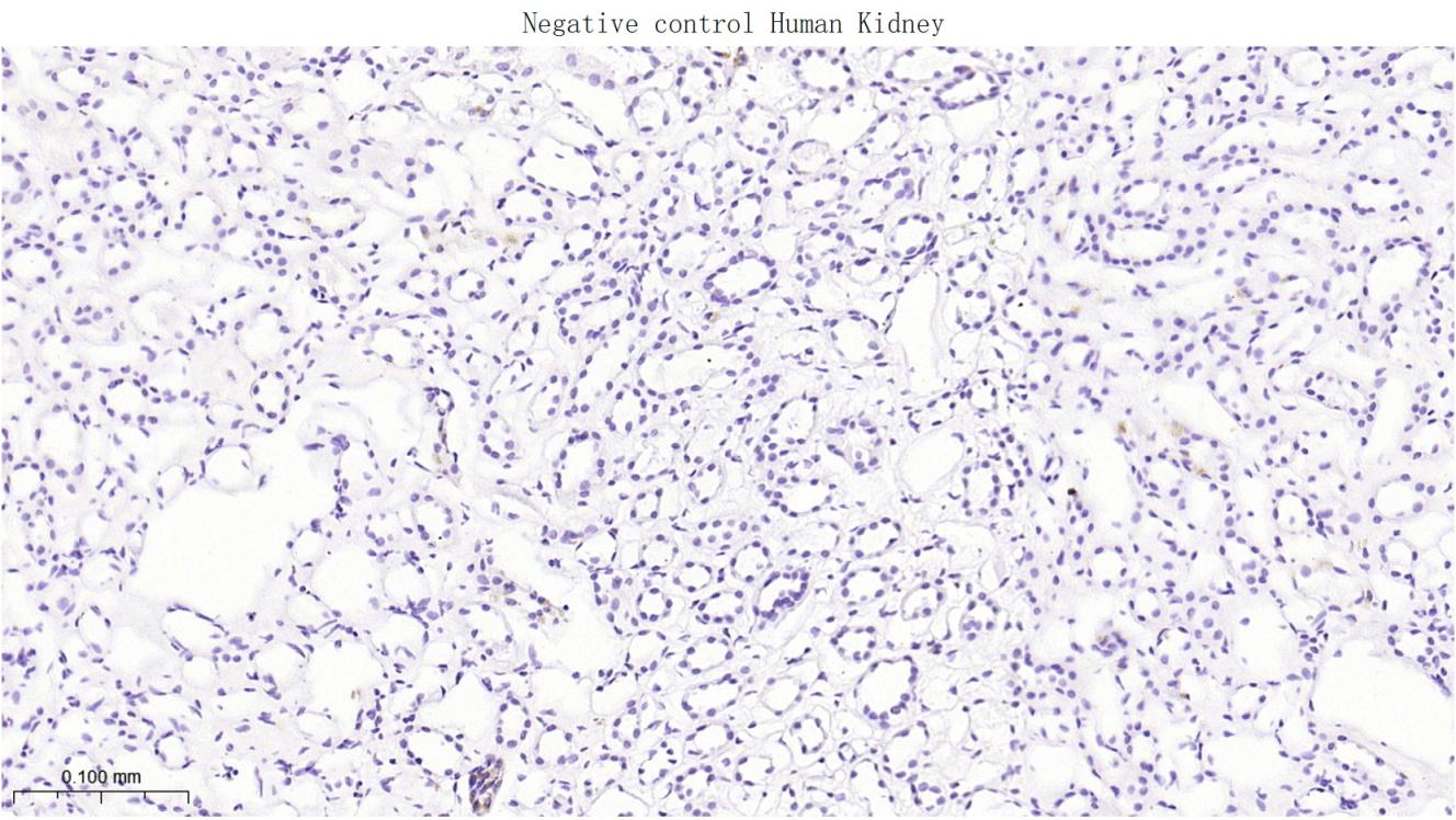 肝肠钙粘连蛋白重组兔单抗-bsm-60434R