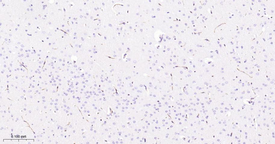 CD34重组兔单抗-bsm-60829R