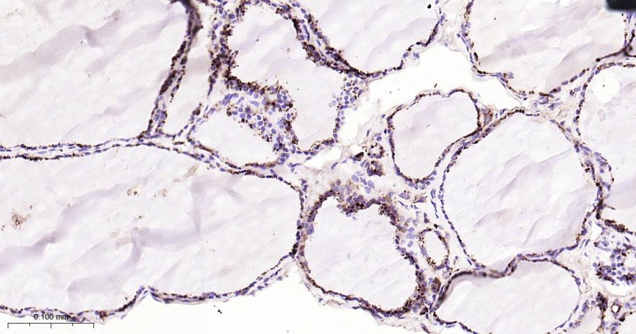 组织蛋白酶D重组兔单抗-bsm-61164R