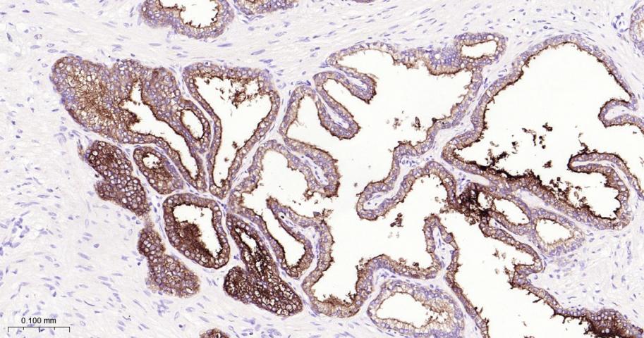 CD10重组兔单抗-bsm-62910R