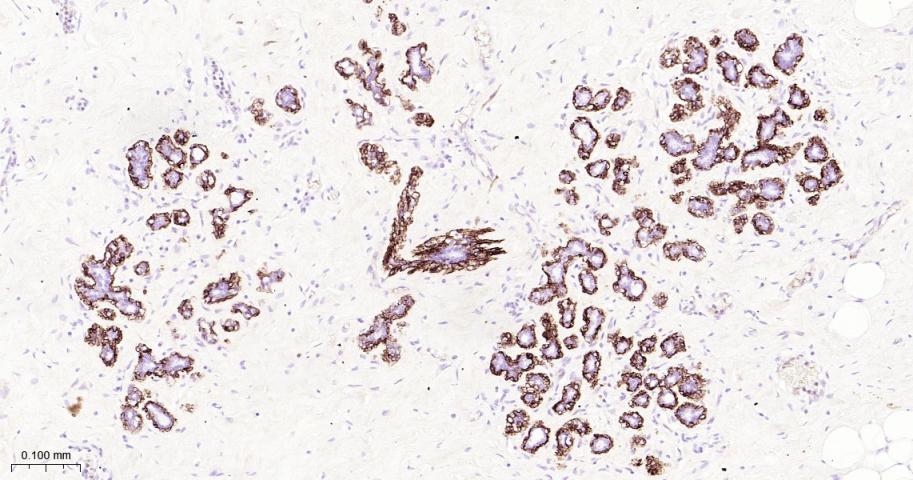 CD10重组兔单抗-bsm-62910R