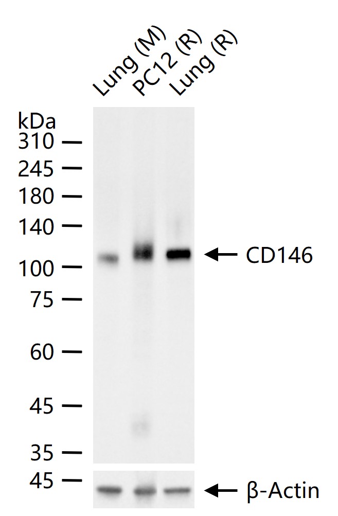 黑色素瘤细胞粘附分子CD146重组兔单抗-bsm-61136R