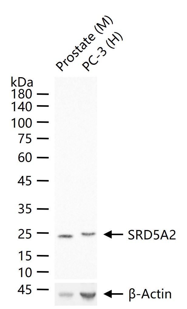类固醇5α还原酶2重组兔单抗-bsm-62269R