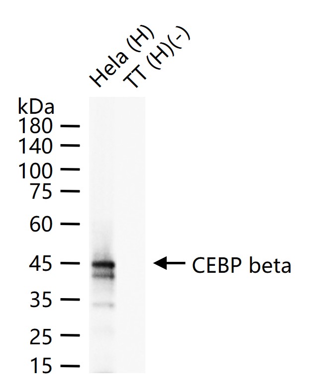 转录调节因子CEBP β重组兔单抗-bsm-61530R